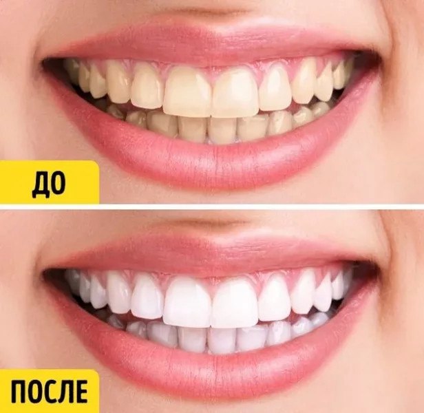 к